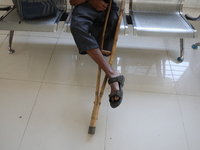 An amputee with a prosthetic limb is inside the Rehabilitation & Research Centre, a unit of Mahavir Seva Sadan, in Arambag on the outskirts...