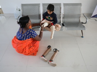 Nandani Dulai, a seven-year-old amputee, receives help from her mother inside the Rehabilitation & Research Centre, a unit of Mahavir Seva S...