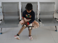 Nandani Dulai, a seven-year-old amputee, wears her prosthetic limbs inside the Rehabilitation & Research Centre, a unit of Mahavir Seva Sada...