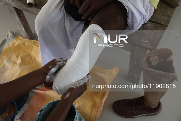 A worker covers a structure with plaster of Paris before manufacturing a prosthetic limb for Pappu Sarnakar, a forty-two-year-old three-whee...