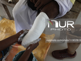 A worker covers a structure with plaster of Paris before manufacturing a prosthetic limb for Pappu Sarnakar, a forty-two-year-old three-whee...