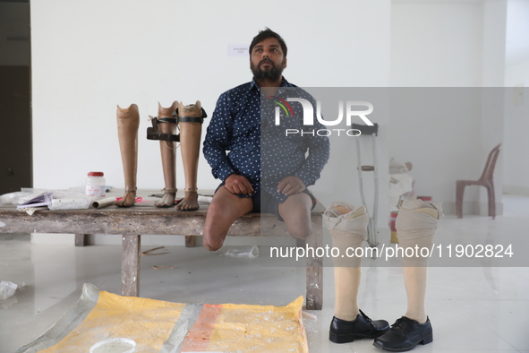 Pappu Sarnakar, a forty-two-year-old amputee and three-wheeler driver, waits for new prosthetic limbs inside the Rehabilitation & Research C...