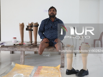 Pappu Sarnakar, a forty-two-year-old amputee and three-wheeler driver, waits for new prosthetic limbs inside the Rehabilitation & Research C...