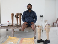 Pappu Sarnakar, a forty-two-year-old amputee and three-wheeler driver, waits for new prosthetic limbs inside the Rehabilitation & Research C...