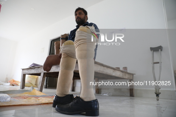 Pappu Sarnakar, a forty-two-year-old amputee and three-wheeler driver, waits for new prosthetic limbs inside the Rehabilitation & Research C...