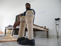 Pappu Sarnakar, a forty-two-year-old amputee and three-wheeler driver, waits for new prosthetic limbs inside the Rehabilitation & Research C...