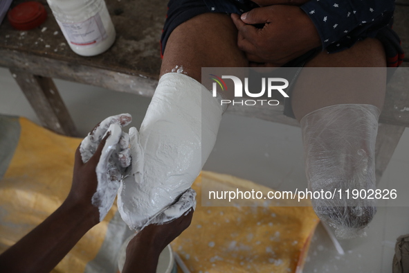 A worker covers a structure with plaster of Paris before manufacturing a prosthetic limb inside the Rehabilitation & Research Centre, a unit...