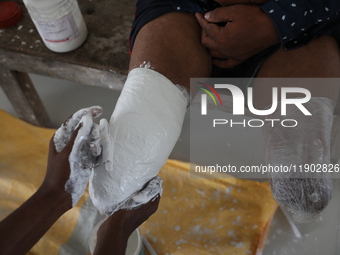 A worker covers a structure with plaster of Paris before manufacturing a prosthetic limb inside the Rehabilitation & Research Centre, a unit...