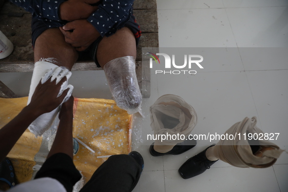 A worker covers a structure with plaster of Paris before manufacturing a prosthetic limb inside the Rehabilitation & Research Centre, a unit...