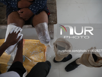 A worker covers a structure with plaster of Paris before manufacturing a prosthetic limb inside the Rehabilitation & Research Centre, a unit...