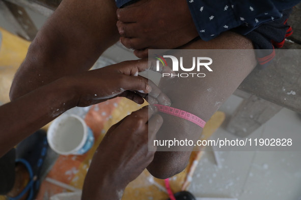 A worker takes measurements before manufacturing a prosthetic limb inside the Rehabilitation & Research Centre, a unit of Mahavir Seva Sadan...