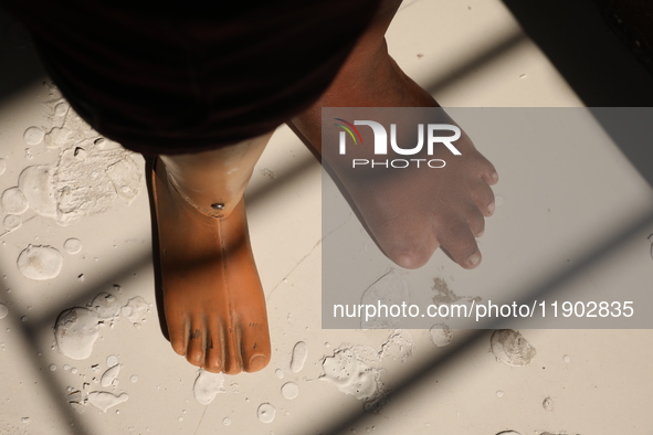 An amputee woman stands with her new prosthetic limb inside the Rehabilitation & Research Centre, a unit of Mahavir Seva Sadan, in Arambag o...