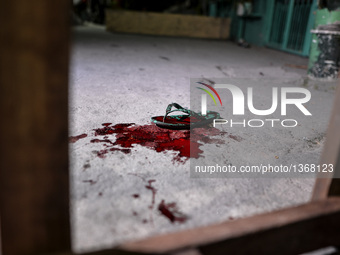 (EDITORS NOTE: Image depicts graphic content.) A slipper and blood from a police officer who was shot following a police anti-drugs operatio...