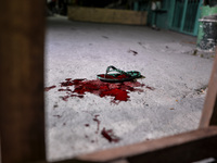 (EDITORS NOTE: Image depicts graphic content.) A slipper and blood from a police officer who was shot following a police anti-drugs operatio...