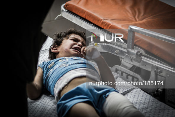 A young boy with a broken leg arrives in Shifa Hospital in Gaza City minutes after her home was attacked with missiles on July 19th, 2014.