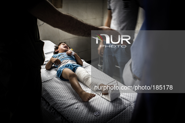 A young boy with a broken leg arrives in Shifa Hospital in Gaza City minutes after his home was attacked with missiles on July 19th, 2014.