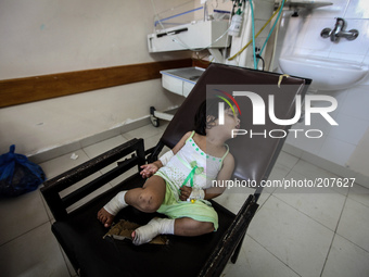 Brothers Omar, Musab and Mohammad are being treated in the children's section in Al-Shifa hospital, Gaza, on August 4, 2014 after sustaining...