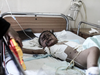 Brothers Omar, Musab and Mohammad are being treated in the children's section in Al-Shifa hospital, Gaza, on August 4, 2014 after sustaining...