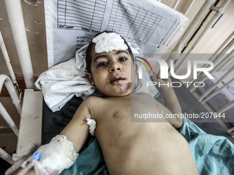 Mohammed Al-Bakri is 3 years old. He is receiving medical treatment in the children's section in Al-Shifa hospital, in Gaza, on August 4, 20...