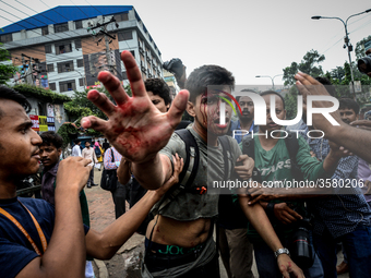 (Editor's Note: Graphic Content) A photographer is targetted during a student protest in Dhaka on August 5, 2018, following the deaths of tw...