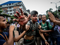 (Editor's Note: Graphic Content) A photographer is targetted during a student protest in Dhaka on August 5, 2018, following the deaths of tw...