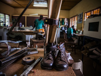 Prosthetic boots for children in the Bombuaka workshop of prostheses, Togo (