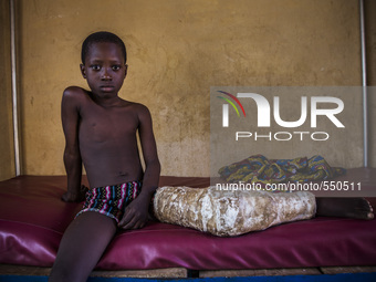 Bombuaka workshop of prostheses, Togo (