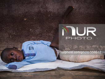 Legs of a child after surgery in the hospital of Don Orione center in  Bombuaka, Togo (