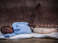 Legs of a child after surgery in the hospital of Don Orione center in  Bombuaka, Togo (