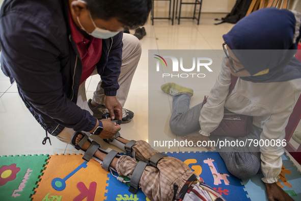 COKI TOBING put on porthetic limb to RAFFASYA son, as his mother Mrs. ENI watched. COKI TOBING, the owner of a prosthetic limb and assistive...