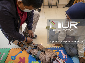 COKI TOBING put on porthetic limb to RAFFASYA son, as his mother Mrs. ENI watched. COKI TOBING, the owner of a prosthetic limb and assistive...