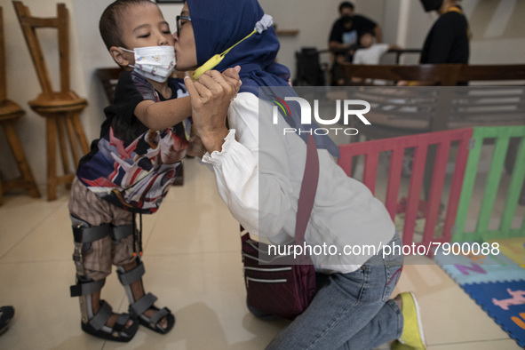 Mrs. ENI RAFFASYA's mother kisses her child who seems to be able to stand with the aid of a prosthetic leg. COKI TOBING, the owner of a pros...