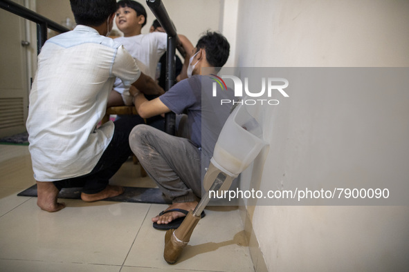 HAVY upon prepared to use the prosthetic leg. COKI TOBING, the owner of a prosthetic limb and assistive device for people with cerebral pals...