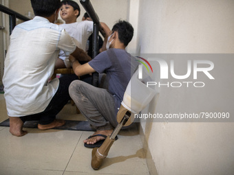 HAVY upon prepared to use the prosthetic leg. COKI TOBING, the owner of a prosthetic limb and assistive device for people with cerebral pals...