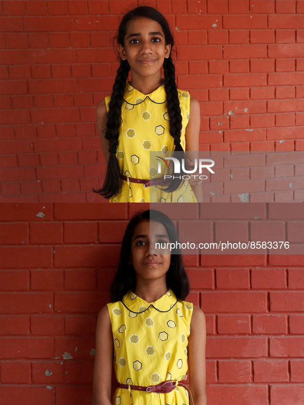 This combination of photographs shows before (top picture) and after (bottom picture) as Yashvi Chopra (10), a young girl who volunteered to...