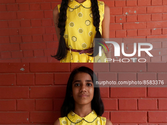 This combination of photographs shows before (top picture) and after (bottom picture) as Yashvi Chopra (10), a young girl who volunteered to...