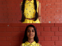 This combination of photographs shows before (top picture) and after (bottom picture) as Yashvi Chopra (10), a young girl who volunteered to...