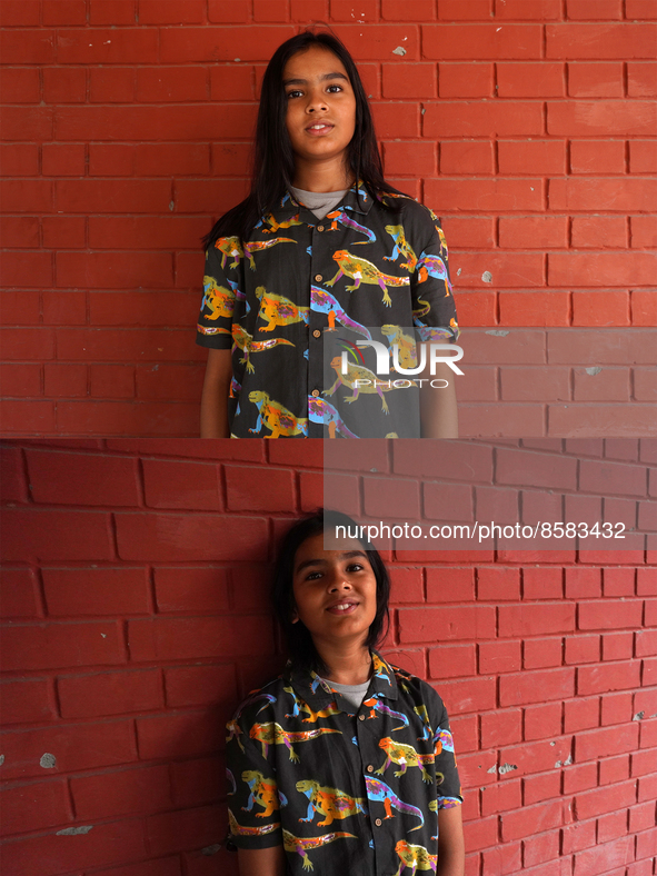 This combination of photographs shows before (top picture) and after (bottom picture) as Subeer Malhotra (10), a young boy, who volunteered...