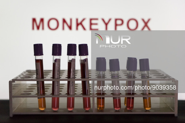 In this photo illustration blood test vials are seen in front of a screen that says "Monkeypox". (Photo Illustration by Nikos Pekiaridis/Nur...