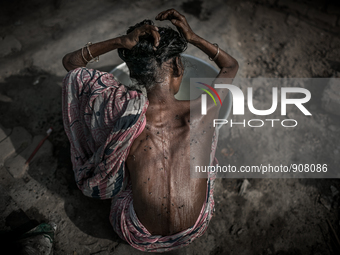 An old woman is washing hair and flies are all over her body at Dhapa west dumping ground, Kolkata, India. January 20, 2015.  *** Go to http...