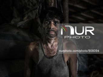 A worker who has been working at Dhapa west dumping ground for 13 years and got skin disease, Kolkata, India. January 17, 2015.  *** Go to h...