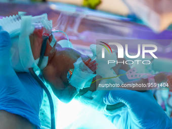 A nurse is taking care of one of the quintuplets laying in an incubator. Krakow, Poland on February 14, 2023. Three girls and two boys were...