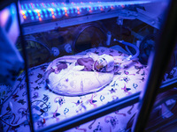 One of the quintuplets, which were born in the University Hospital, is seen in an incubator. Krakow, Poland on February 14, 2023. Three girl...