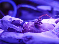 One of the quintuplets, which were born in the University Hospital, is seen in an incubator. Krakow, Poland on February 14, 2023. Three girl...