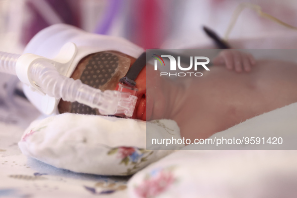 One of the quintuplets, which were born in the University Hospital, is seen in an incubator. Krakow, Poland on February 14, 2023. Three girl...