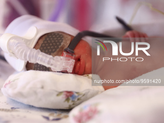 One of the quintuplets, which were born in the University Hospital, is seen in an incubator. Krakow, Poland on February 14, 2023. Three girl...