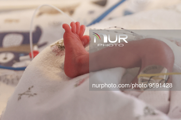 A tiny leg of one of the quintuplets, which were born in the University Hospital, is seen in an incubator. Krakow, Poland on February 14, 20...