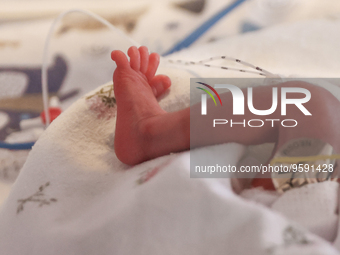 A tiny leg of one of the quintuplets, which were born in the University Hospital, is seen in an incubator. Krakow, Poland on February 14, 20...