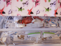 One of the quintuplets, which were born in the University Hospital, is seen in an incubator. Krakow, Poland on February 14, 2023. Three girl...