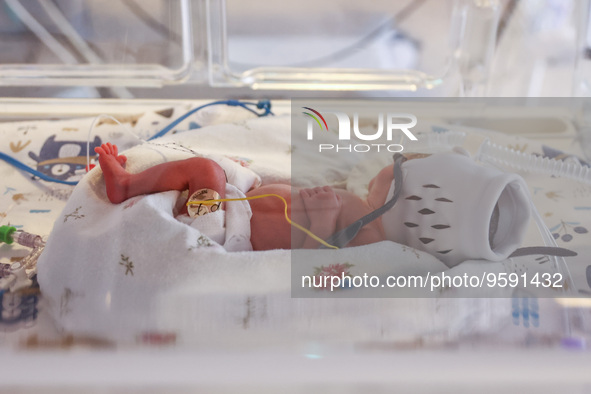 One of the quintuplets, which were born in the University Hospital, is seen in an incubator. Krakow, Poland on February 14, 2023. Three girl...